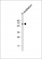 SPPL2B Antibody (Center)
